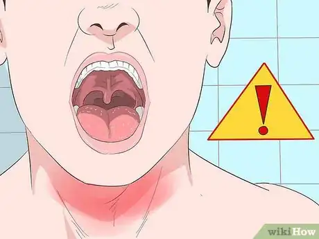 Image intitulée Get Rid of a Sore Throat Quickly Step 21