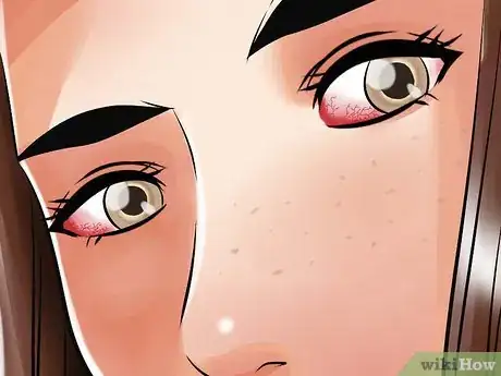 Image intitulée Reduce Bags Under Your Eyes Step 11