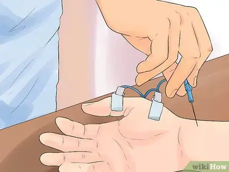 Image intitulée Diagnose Carpal Tunnel Syndrome Step 11