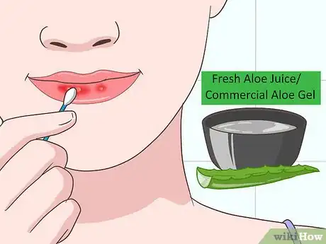 Image intitulée Heal Sunburned Lips Step 1