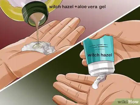 Image intitulée Apply Witch Hazel to Your Face Step 9