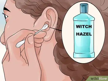 Image intitulée Get Rid of Pimples Inside the Ear Step 3