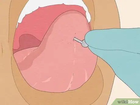Image intitulée Pierce Your Own Tongue Step 10