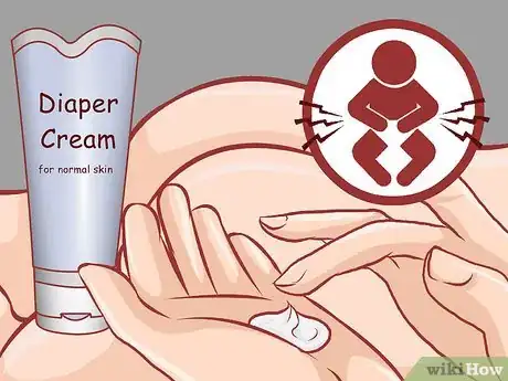 Image intitulée Apply Diaper Cream Step 5