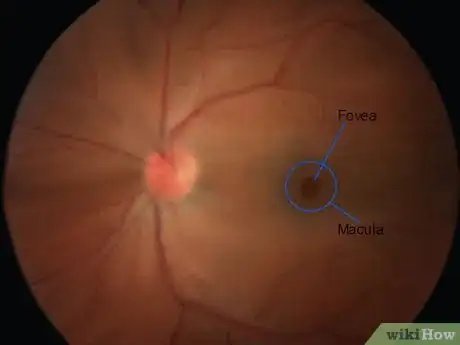 Image intitulée Use an Ophthalmoscope Step 15