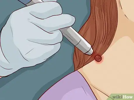 Image intitulée Remove a Skin Tag from Your Neck Step 4