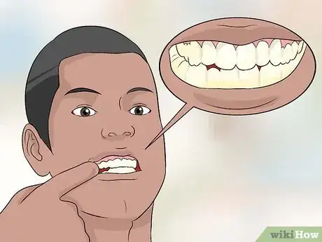 Image intitulée Restore Tooth Enamel Step 2