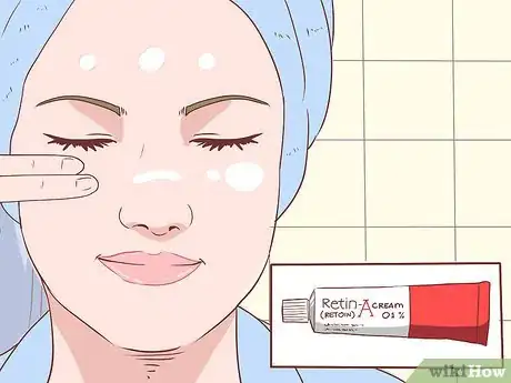 Image intitulée Treat Acne (Teenage Girls) Step 15