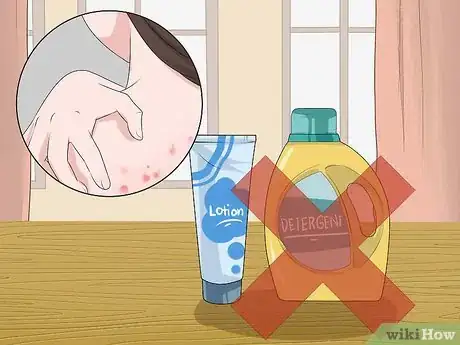 Image intitulée Get Rid of Back Acne Fast Step 11