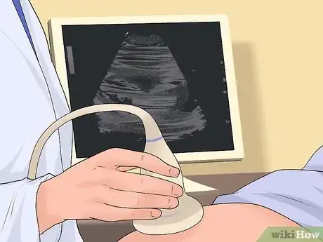 Image intitulée Deal with Placenta Previa Step 3