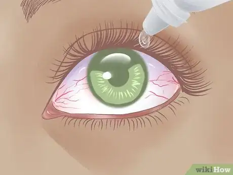 Image intitulée Make Your Eyes Look Good Without Makeup Step 4