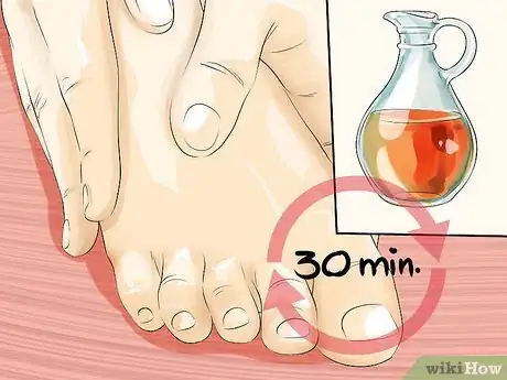 Image intitulée Remove Calluses Naturally Step 9