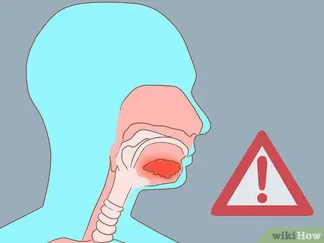 Image intitulée Unclog a Salivary Duct Step 5