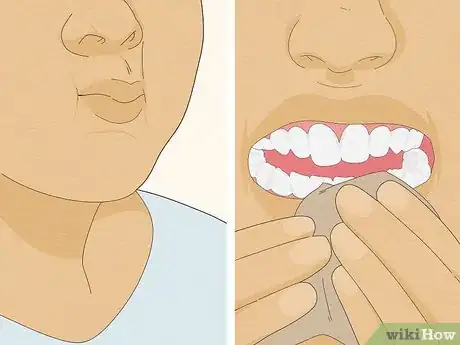 Image intitulée Fix Bad Breath on the Spot Step 9