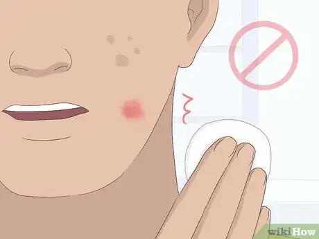 Image intitulée Apply Calamine Lotion Step 12