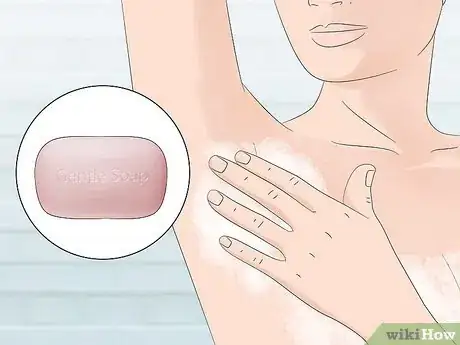 Image intitulée Stop Armpit Pimples Step 1