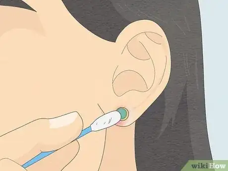 Image intitulée Clean Your Ear Piercing Step 3