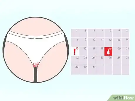 Image intitulée Recognize Implantation Bleeding Step 1