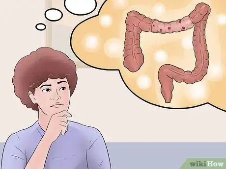 Image intitulée Distinguish Ulcerative Colitis from Similar Conditions Step 11