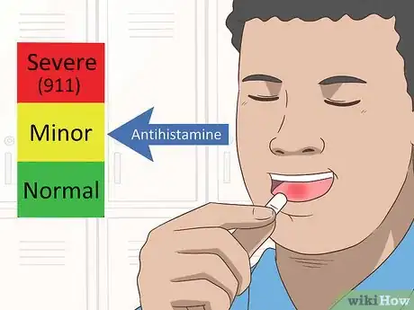 Image intitulée Reduce Tongue Swelling Step 3