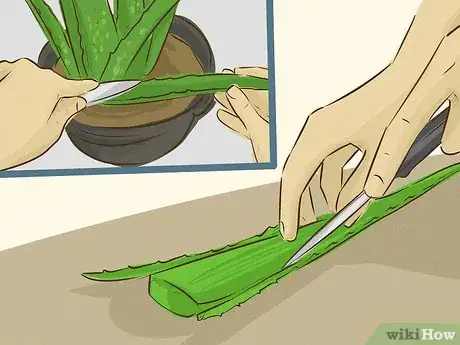 Image intitulée Use Aloe Vera to Treat Burns Step 5