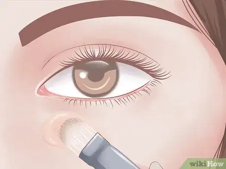 Image intitulée Reduce Puffy Eyes Step 16