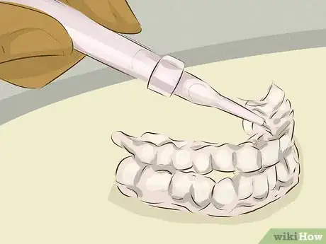 Image intitulée Whiten Teeth Step 7