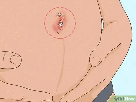 Image intitulée Manage Belly Button Rings During Pregnancy Step 6