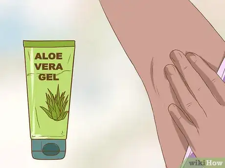 Image intitulée Get Rid of a Zit on Your Armpit Step 9
