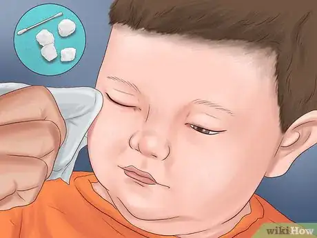 Image intitulée Administer Eye Drops in Children Step 12