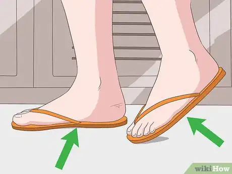 Image intitulée Treat Toe Nail Fungus Step 12