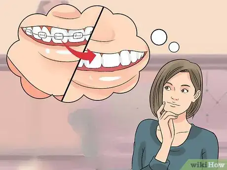 Image intitulée Prepare on the Day You Get Braces Step 1