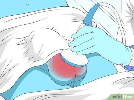 Image intitulée Know if You Have Epididymitis Step 15