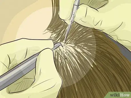 Image intitulée Help Your Hair Grow Faster when You Have a Bald Spot Step 22