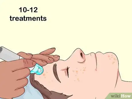 Image intitulée Remove Facial Hair Permanently Step 5