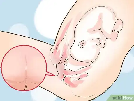 Image intitulée Check a Cervix for Dilation Step 13