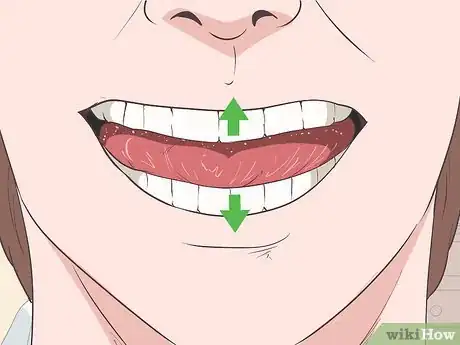 Image intitulée Alleviate Temporomandibular Joint Disorder (TMD) Step 3