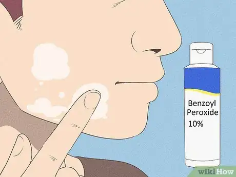 Image intitulée Get Rid of Acne if You Have Fair Skin Step 17