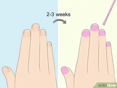 Image intitulée Heal Damaged Nails Step 6