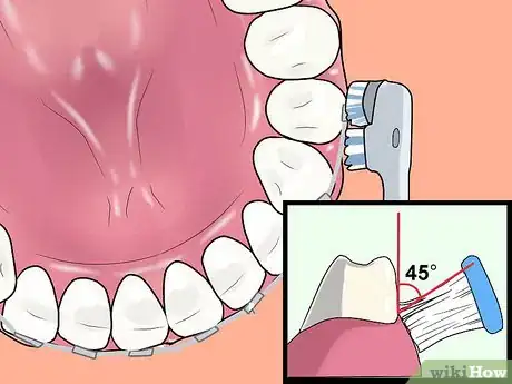 Image intitulée Use an Electric Toothbrush with Braces Step 9