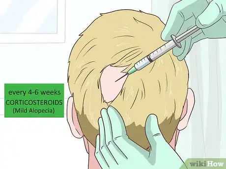 Image intitulée Treat Alopecia Step 1