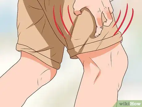 Image intitulée Tell Signs of Sexual Infection from Penis Step 13