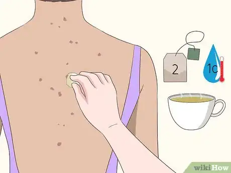 Image intitulée Get Rid of Back Acne Scars Step 7