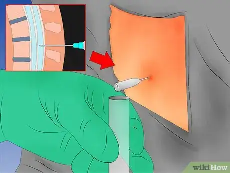 Image intitulée Diagnose Multiple Sclerosis Step 6