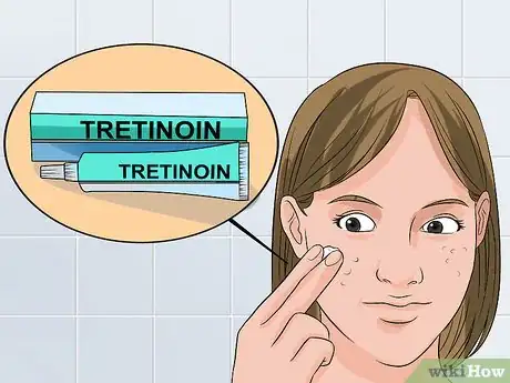 Image intitulée Use Tretinoin and Benzoyl Peroxide Concurrently Step 12