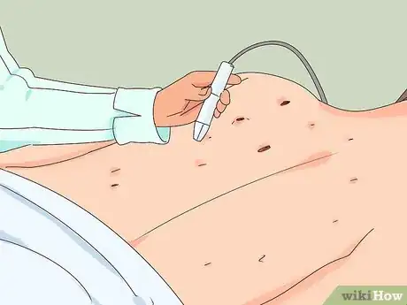 Image intitulée Remove Blackheads on Your Back Step 5