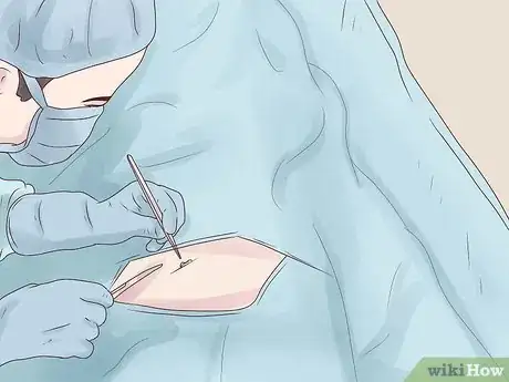 Image intitulée Treat Blocked Fallopian Tubes Step 13