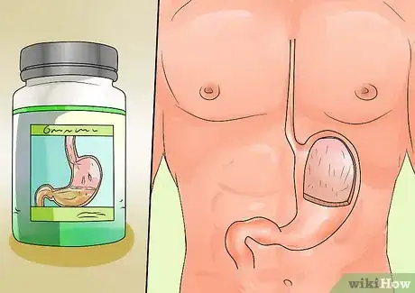 Image intitulée Cure H. Pylori Naturally Step 13