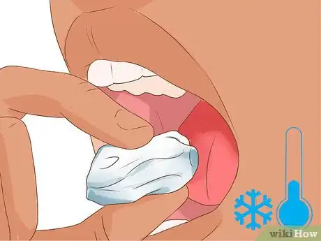 Image intitulée Heal a Bitten Tongue Step 12