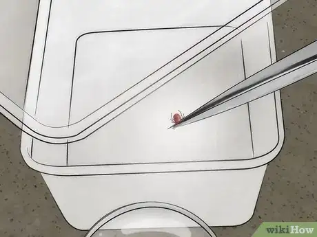Image intitulée Get Rid of Bug Bites Step 16